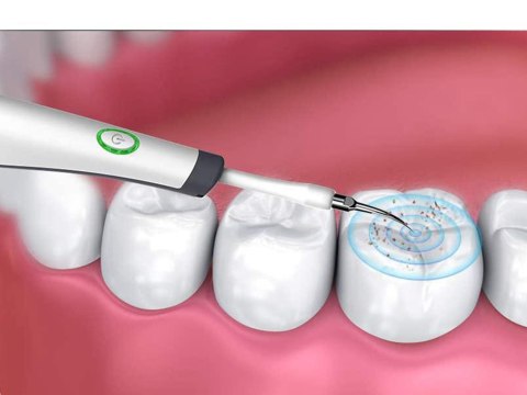 Skaler dentystyczny ultradźwiękowy do kamienia